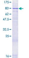Human GLP2R Protein (Recombinant GST)