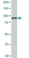 IHC-plus™ Monoclonal Mouse anti-Human ACTN4 Antibody (clone 4D10, IHC, IF, WB)