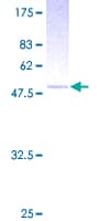 Human TSG / TWSG1 Protein (Recombinant GST)