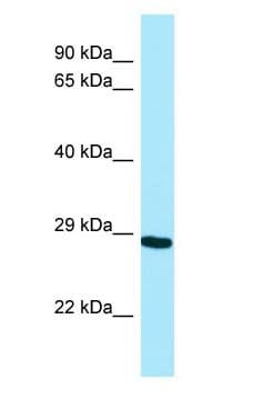 NEIL2 Antibody (aa64-113)
