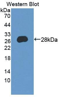LYPLA1 Antibody (aa1-230, PE)