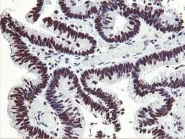 HOXC11 Antibody (aa1-304, clone OTI3E10, Carrier-free)
