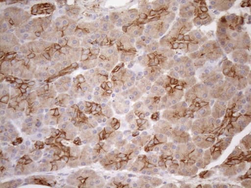 Monoclonal Mouse anti-Human KRT16 / CK16 / Cytokeratin 16 Antibody (clone OTI1G1, IHC, WB)