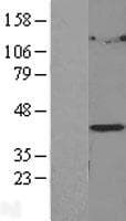 LPGAT1 Protein (Over-Expression Lysate Myc-DDK (Flag))