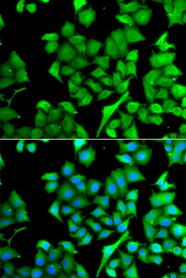 Polyclonal Rabbit anti-Human NAA50 / NAT13 / SAN Antibody (IHC, IF, WB)