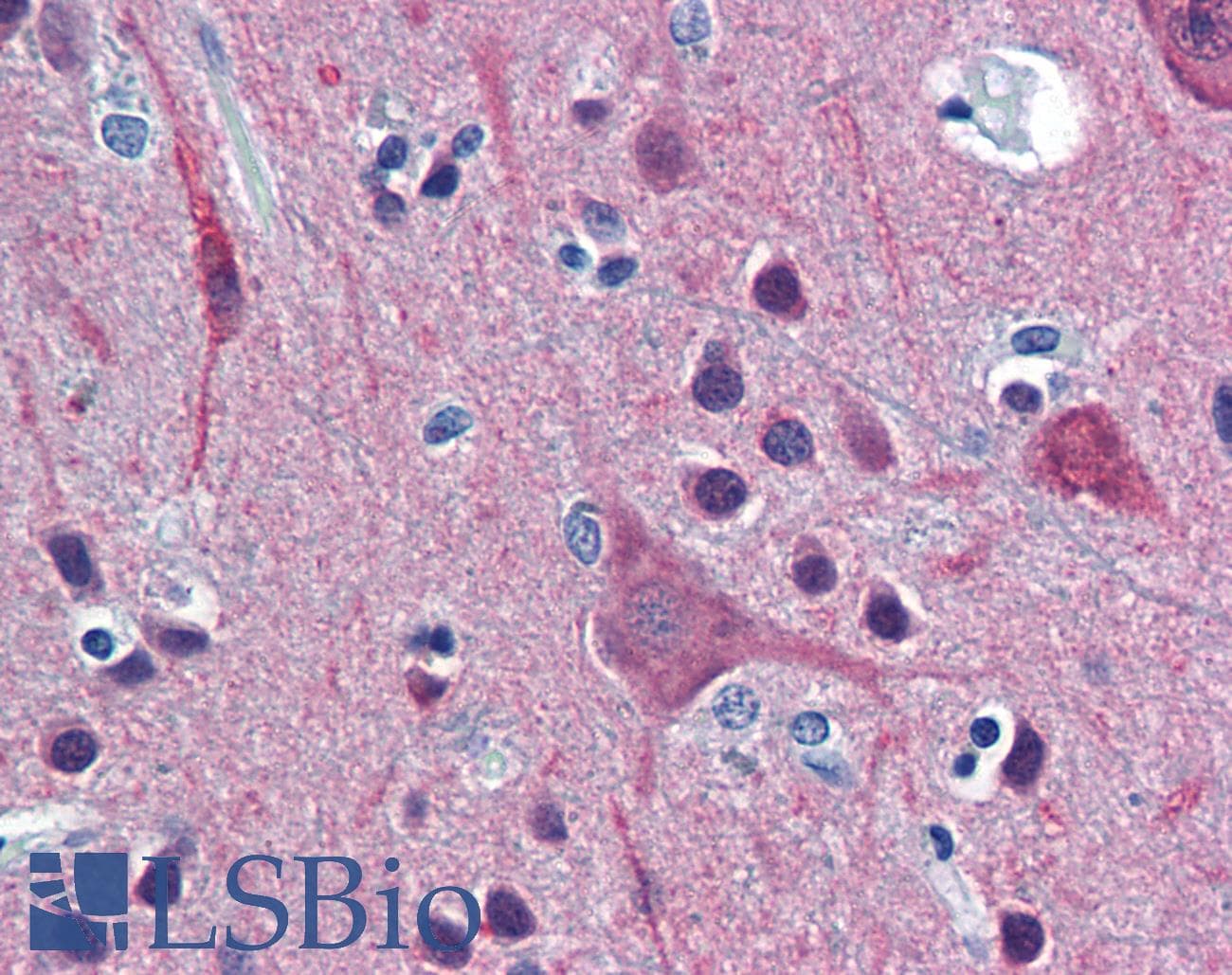 PathPlus™ UCHL1 / PGP9.5 Antibody (aa171-220)