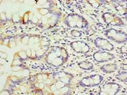 SULT1E1 / Sulfotransferase 1E1 Antibody