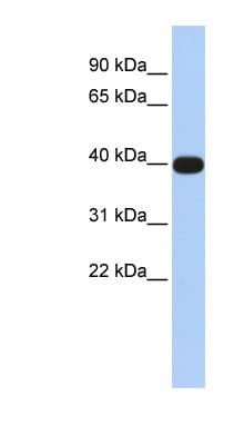 LMX1A Antibody (N-Terminus)