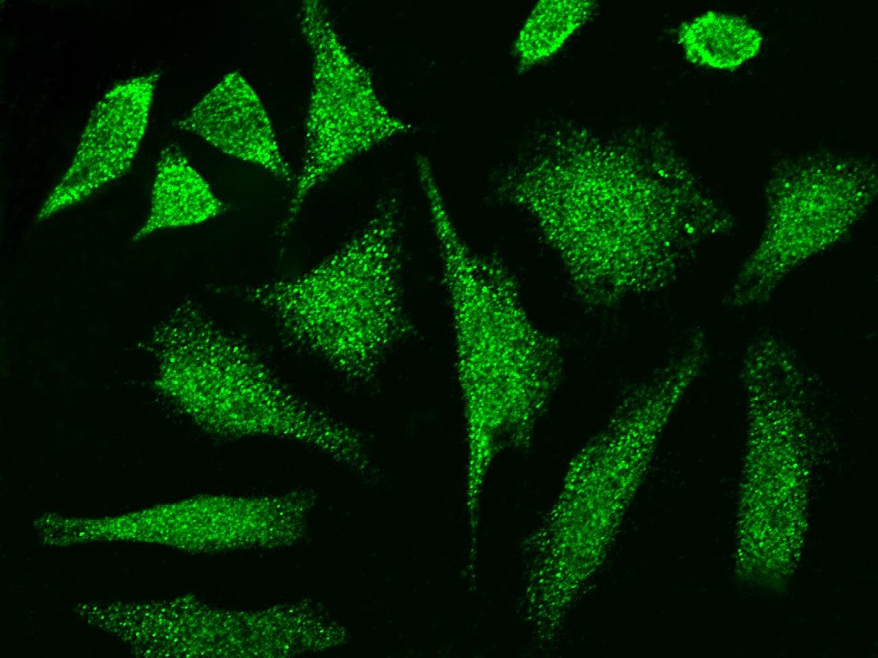 Polyclonal Rabbit anti-Human CCDC6 Antibody (Preservative Free, IHC, IF)