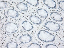 KRT8 / CK8 / Cytokeratin 8 Antibody (clone OTI1B12)