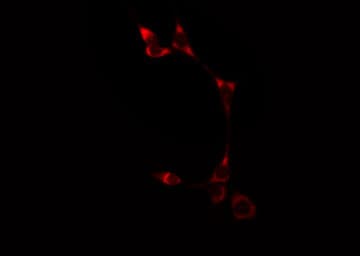Polyclonal Rabbit anti-Human ATP2A1 / SERCA1 Antibody (IF, WB)