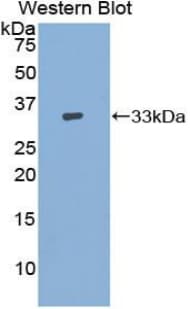 ADCY9 / Adenylate Cyclase 9 Antibody (aa1029-1282, PE)