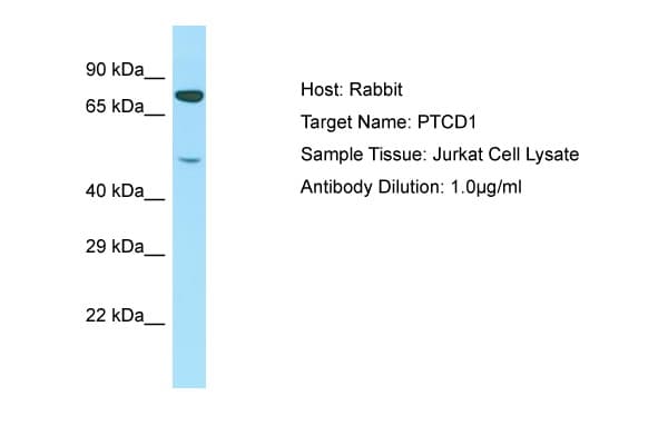 Polyclonal Rabbit anti-Human PTCD1 Antibody (aa51-100, WB)