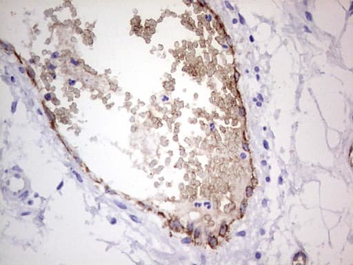 VWF / Von Willebrand Factor Antibody (aa764-1263, clone OTI9B3)