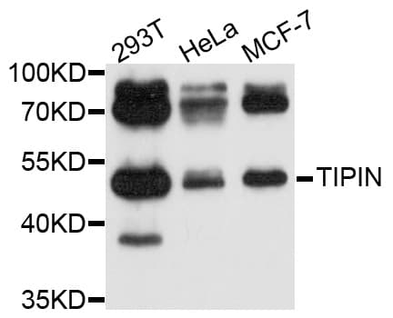 TIPIN Antibody