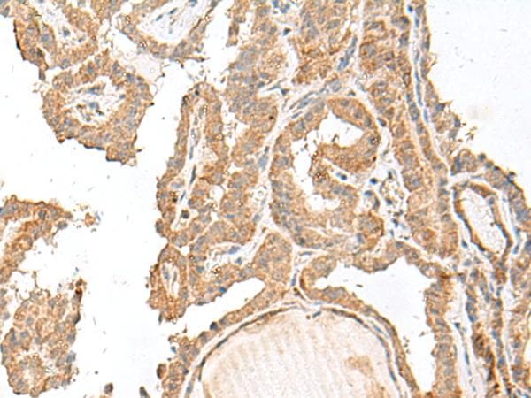 Polyclonal Rabbit anti-Human GART / GARS Antibody (IHC)