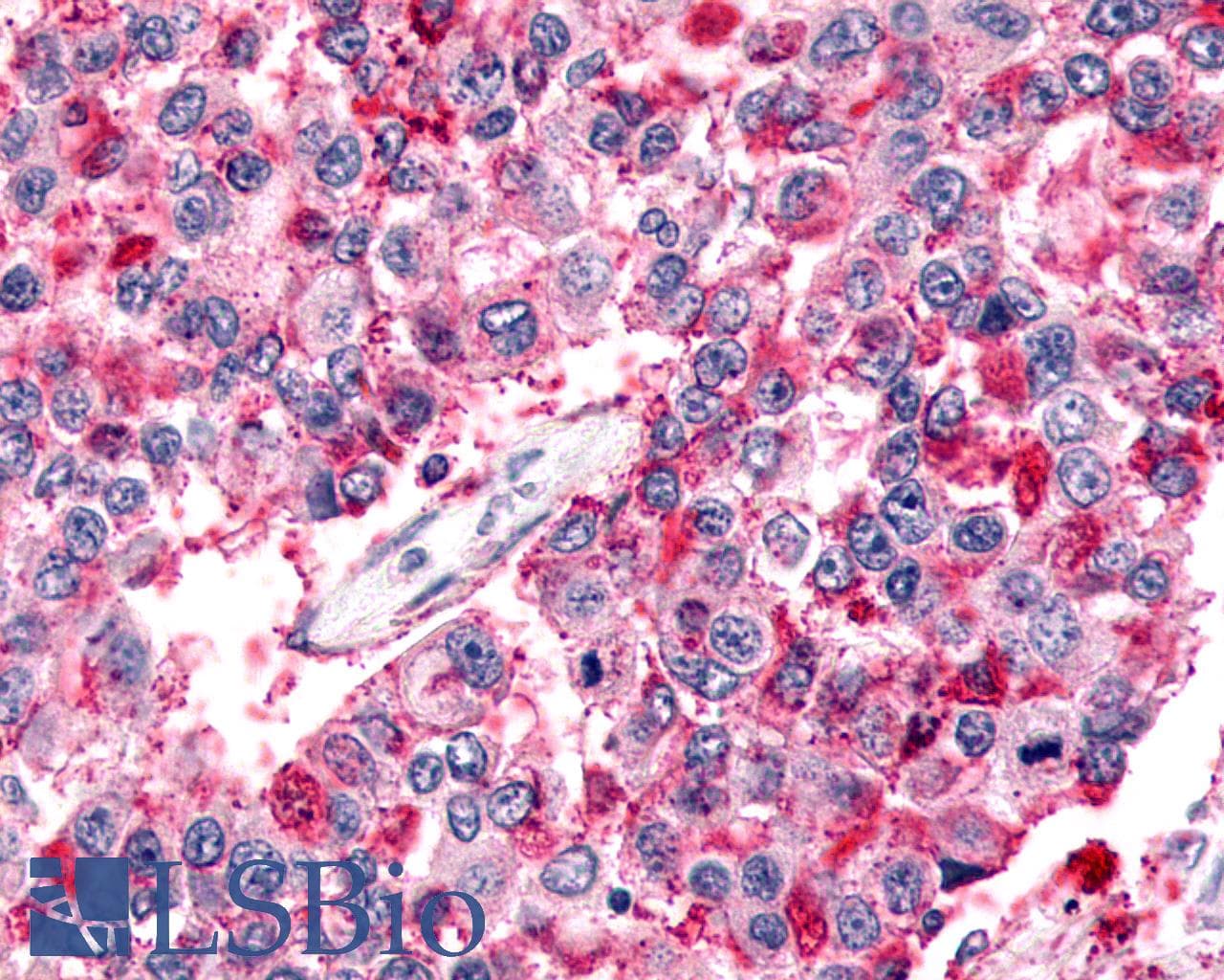 PathPlus™ ADGRB2 / BAI2 Antibody (N-Terminus)