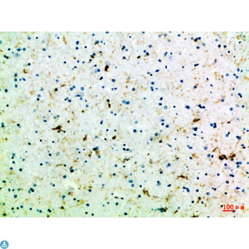 FZD4 / Frizzled 4 Antibody