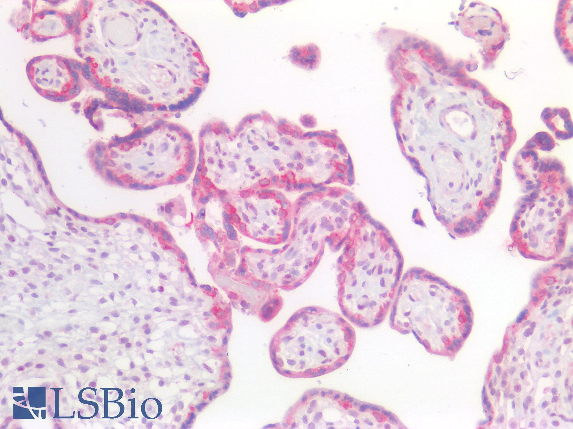 PathPlus™ Polyclonal Rabbit anti-Human INHBA / Inhibin Beta A Antibody (aa35-84, IHC, WB)