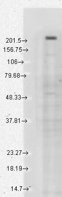IHC-plus™ TRPM7 Antibody (aa1817-1863, clone S74-25)