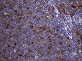 NME1 / NM23 Antibody (clone OTI22F10)
