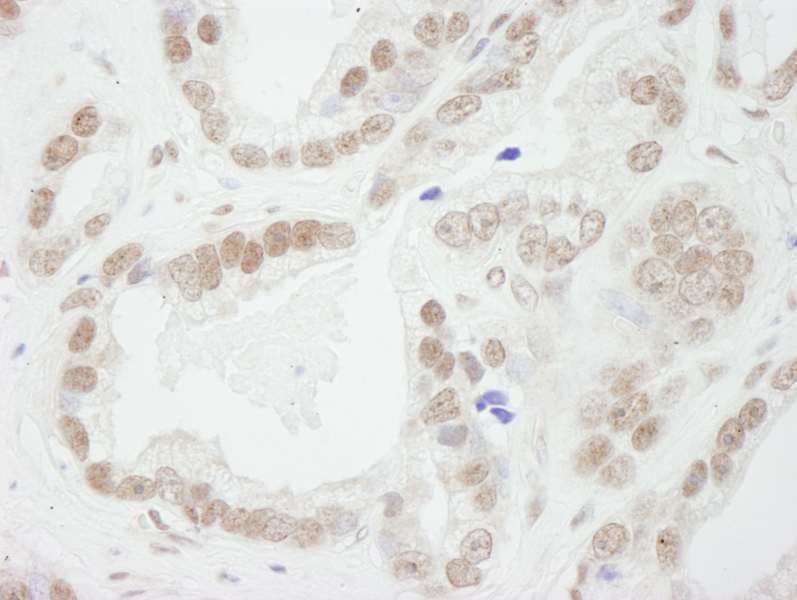 Polyclonal Rabbit anti-Human BUB3 Antibody (aa275-325, IHC)