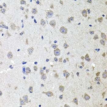 ALPL / Alkaline Phosphatase Antibody