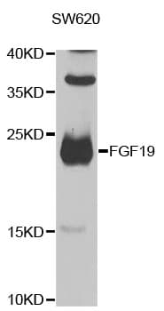 PathPlus™ Polyclonal Rabbit anti-Human FGF19 Antibody (IHC, WB)