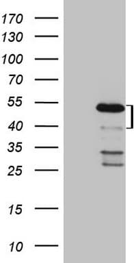 Monoclonal Mouse anti-Human MKX Antibody (clone OTI6A12, Carrier-free, IHC, WB)