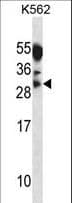 MYOG / Myogenin Antibody (aa123-150)