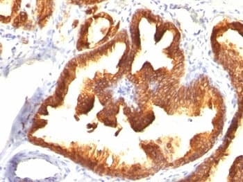 KRT18 / CK18 / Cytokeratin 18 Antibody (clone KRT18/836)
