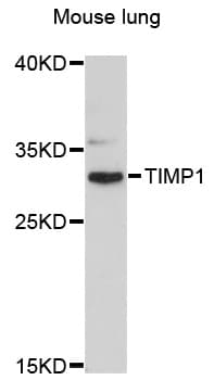 TIMP1 Antibody