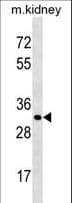 CTSL / Cathepsin L Antibody (aa267-294)