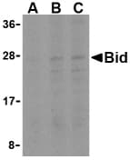 IHC-plus™ Polyclonal Rabbit anti-Human BID Antibody (IHC, WB)