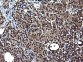 DOK7 Antibody (clone OTI1F7)