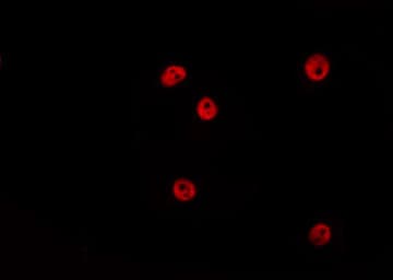 HOXA5 Antibody