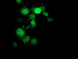 GDAP1L1 Antibody (clone OTI1A5)