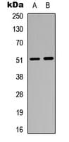 GABRA6 Antibody (Internal)