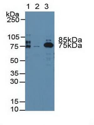 F2 / Prothrombin / Thrombin Antibody (aa324-617)