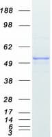 Human Vitamin D Receptor / VDR Protein (Recombinant Myc-DDK (Flag))