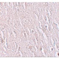 Polyclonal Rabbit anti-Human ZBTB5 Antibody (IHC, IF, WB)