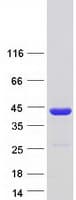 Human NACA Protein (Recombinant Myc-DDK (Flag))