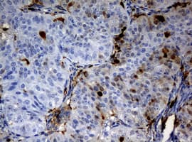 TP / Thymidine Phosphorylase Antibody (clone OTI5B5)