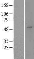 CST / GAL3ST1 Protein (Over-Expression Lysate Myc-DDK (Flag))