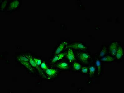 SOCS7 / SOCS-7 Antibody