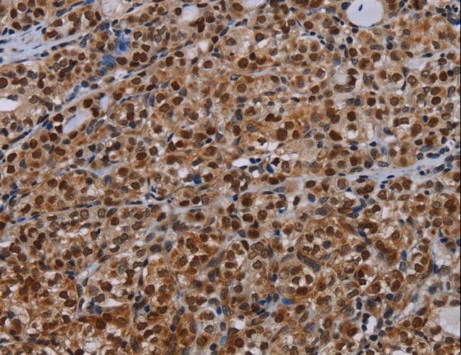 Polyclonal Rabbit anti-Human DCAF6 / NRIP Antibody (IHC)