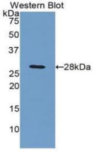 C4BPB / C4BP Beta Antibody (aa18-252, FITC)
