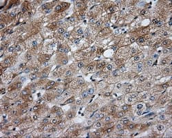 PRKAR2A Antibody (clone OTI4A3)
