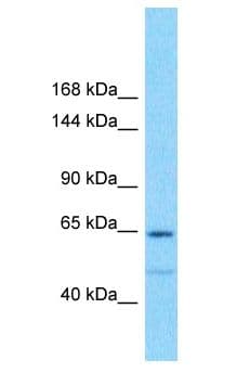Polyclonal Rabbit anti-Human GOLGA6L1 Antibody (aa282-331, WB)