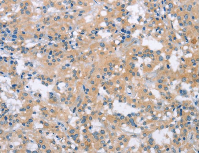 MCL1 / MCL 1 Antibody
